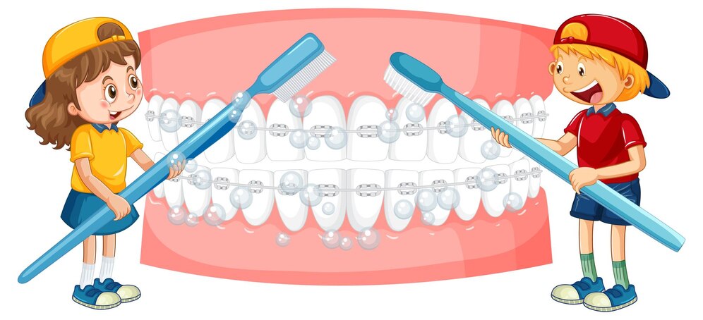 Orthodontic Braces